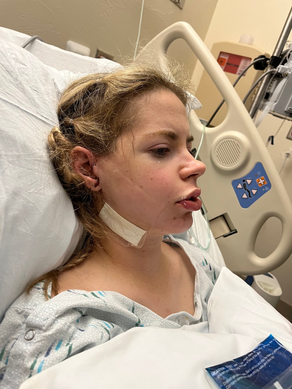 5 | Two days&nbsp;later…