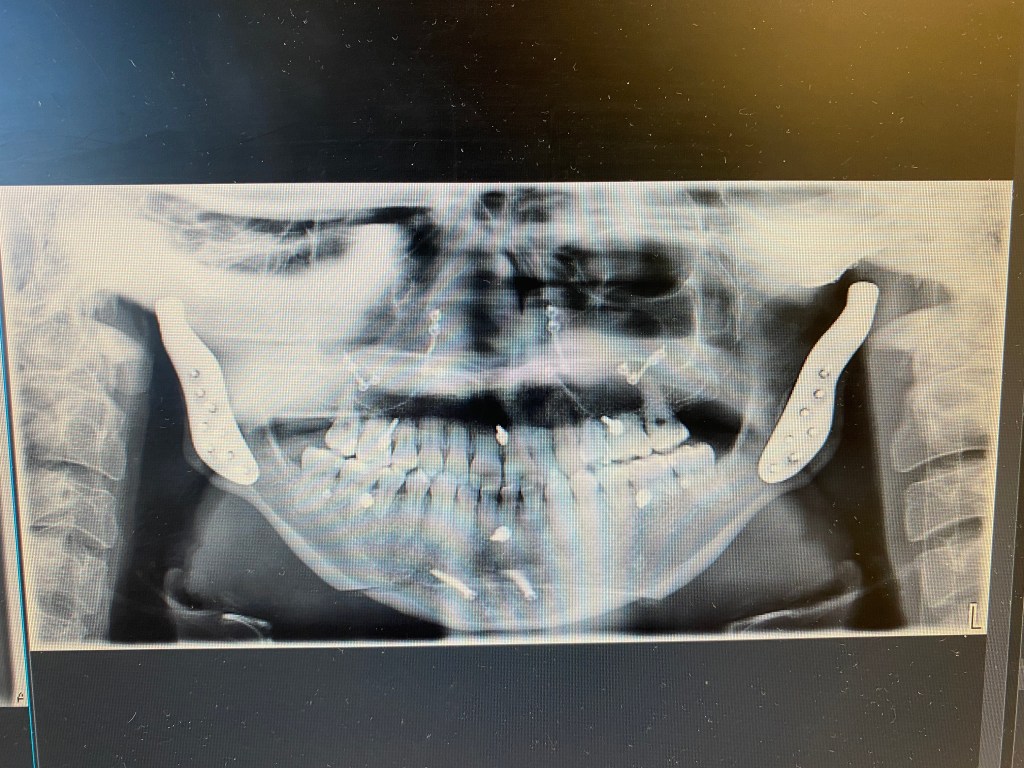 10 | Checkup&nbsp;Appointment