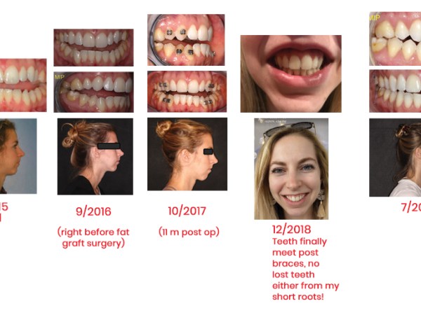 2002-2022 My Jaw&nbsp;Journey