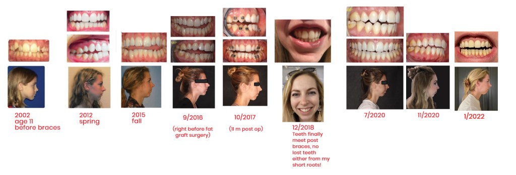 2002-2022 My Jaw&nbsp;Journey