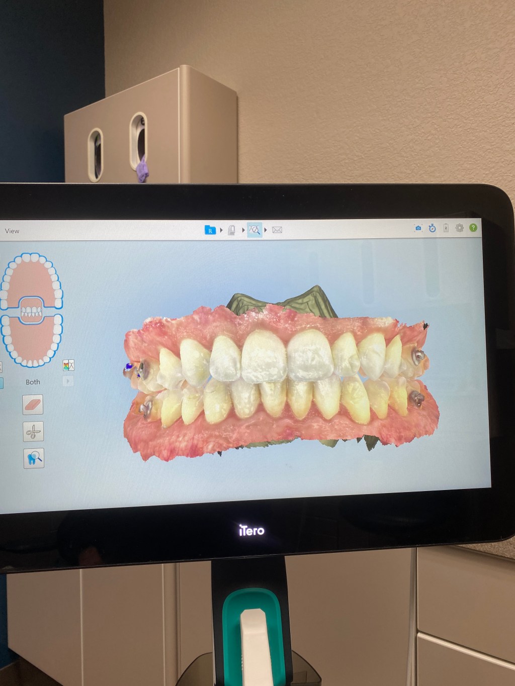 15 | 7 months post&nbsp;op